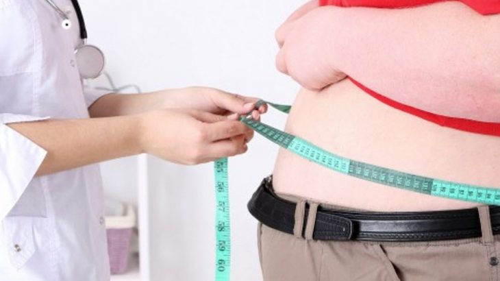 obezite, obezite belirtileri ve tedavisi